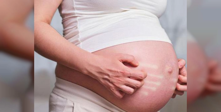 Gebelikte Kaşıntı: Op. Dr. Fatih Mehmet Kaya Uyardı