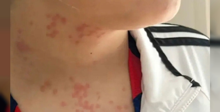 Binlerce kilometre ötede dehşet: KLM uçağında böcek istilası yolcuları isyan ettirdi!