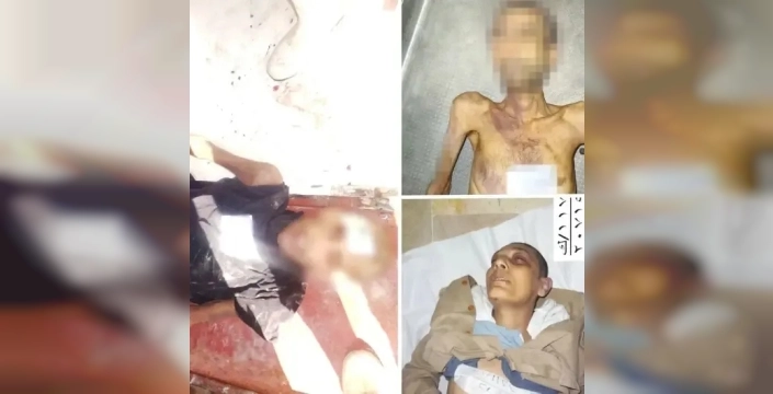 Suriye'de rejimden dehşet verici işkence belgeleri sızdı: 10 binden fazla kurbanın kanıtları ortaya çıktı