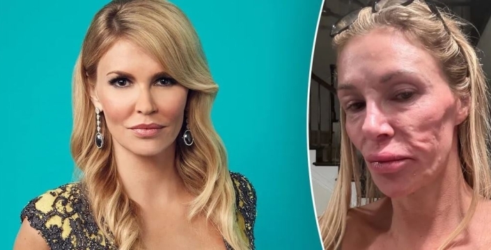 Ünlü yıldızın yüzündeki gizemli hastalık çözüldü: 130 bin dolar harcadı, sonunda teşhis konuldu!