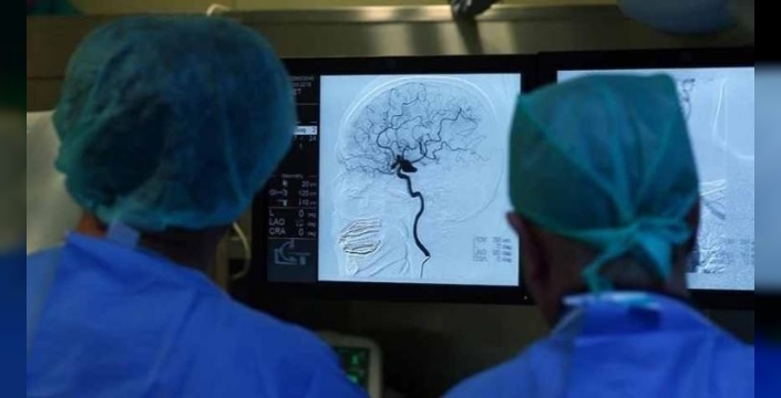 Beynimiz 57, 70 ve 78 yaşlarında 'vites düşürüyor': İşte yaşlanmanın üç kritik dönemeci