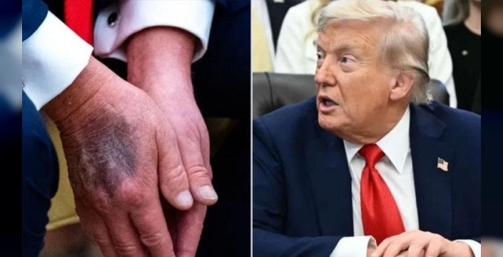 Trump, morluklarının sebebini aspirin olarak açıkladı