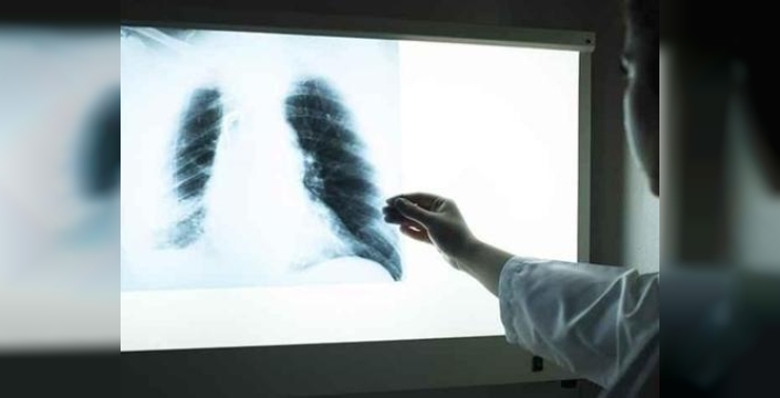 Fransa'da şok edici vaka: Hastaneye giden adamın vücudundan 1. Dünya Savaşı'ndan kalma top mermisi çıktı