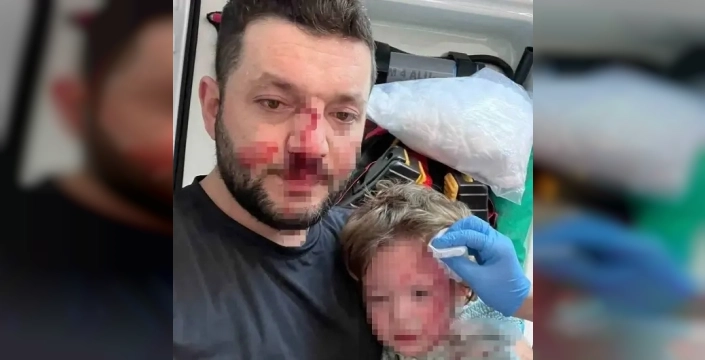 Yalova'da komşu kavgasında baba ve bebeğe saldıran şahsa ağır ceza talebi